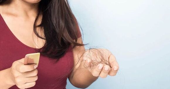 Perdita di capelli dal cuoio capelluto