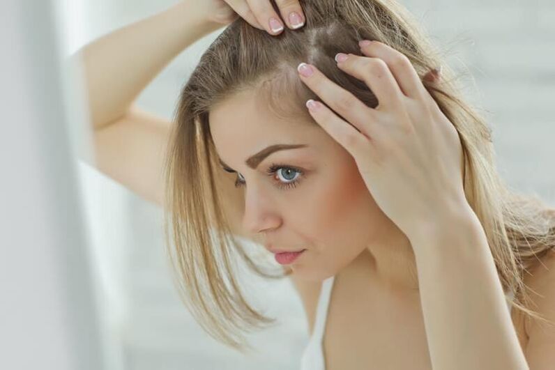 Una ragazza esamina i focolai di alopecia
